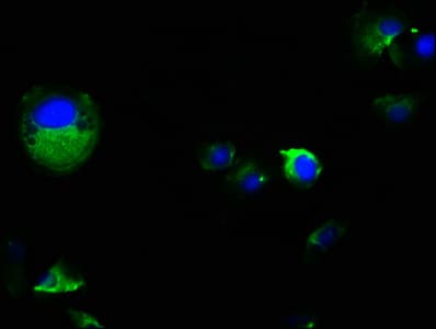 PKD2 / Polycystin 2 Antibody
