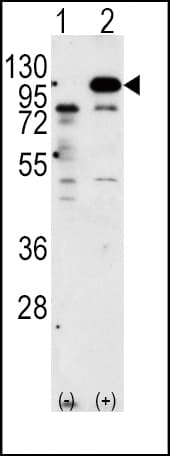 APP / Beta Amyloid Precursor Antibody (aa736-770)