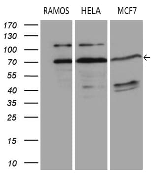 DCP1B Antibody (aa167-473, clone OTI1C5)