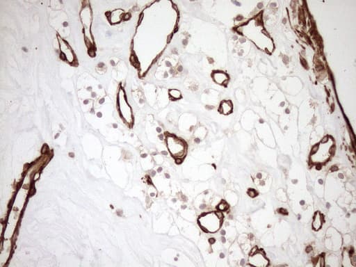 Monoclonal Mouse anti-Human ASPDH Antibody (clone OTI4G8, IHC)