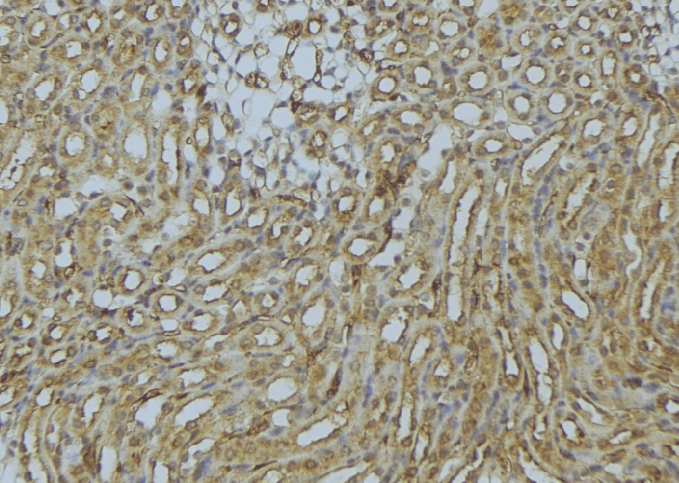 SNX17 Antibody