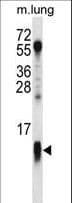COX7A1 Antibody (aa10-38)