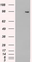 Monoclonal Mouse anti-Human TYRO3 Antibody (clone OTI2G2, IHC, WB)