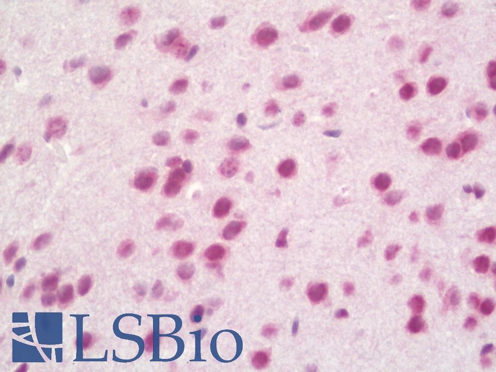 IHC-plus™ Polyclonal Rabbit anti-Mouse PXK Antibody (aa164-193, IHC, WB)