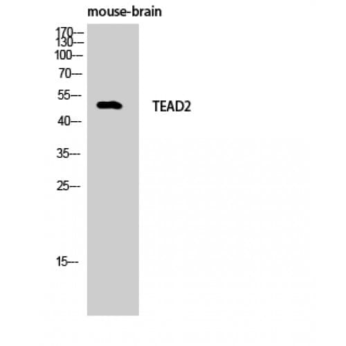TEAD2 Antibody (40-120 aa, Internal)