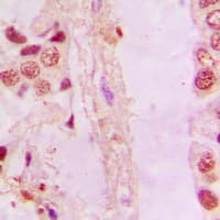 Polyclonal Rabbit anti-Human NFE2L2 / NRF2 Antibody (C-Terminus, IHC, IF, WB)