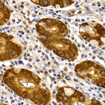 TFF1 / pS2 Antibody