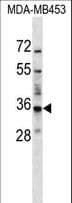 Polyclonal Rabbit anti-Human BATF2 / SARI Antibody (aa16-43, WB)
