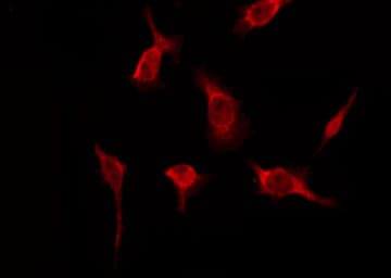 OR51A2 Antibody