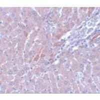 LYRM1 Antibody