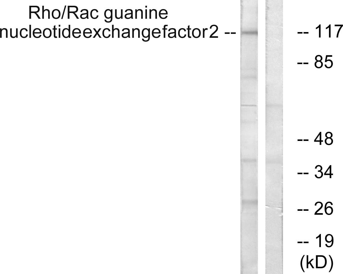 Polyclonal Rabbit anti-Human ARHGEF2 / GEF-H1 Antibody (aa851-900, WB)