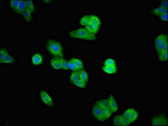 Polyclonal Rabbit anti-Human UBASH3A / CLIP4 Antibody (IF)