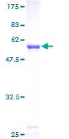 Human MTAP Protein (Recombinant GST)