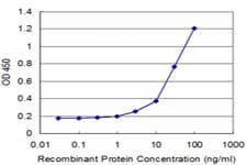 Monoclonal Mouse anti-Human EPM2A / Laforin Antibody (clone 4A12, WB)