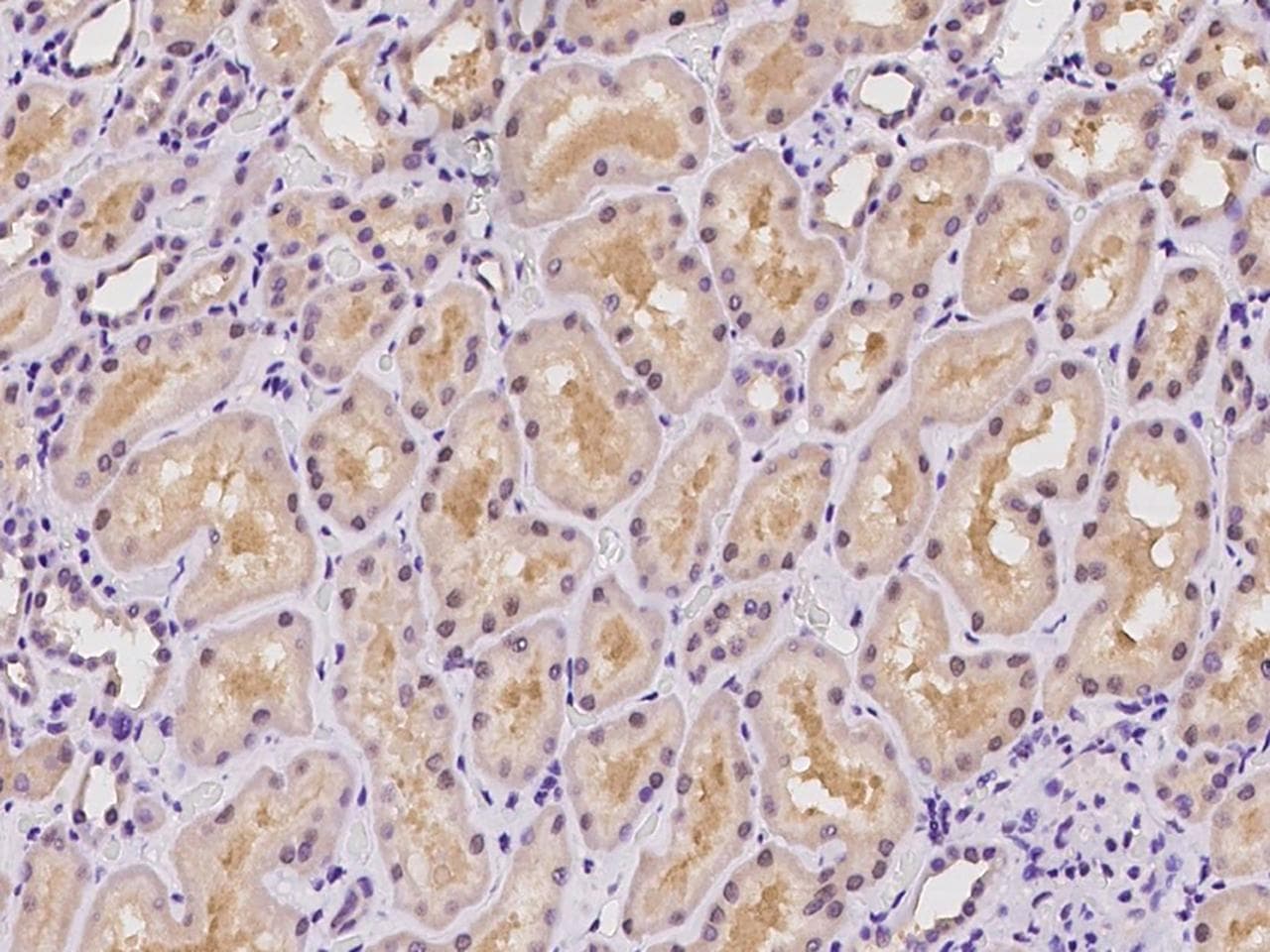 AFG3L2 Antibody
