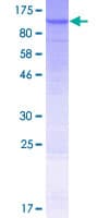 Human ABCB2 / TAP1 Protein (Recombinant GST)