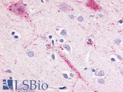 PathPlus™ BOB / GPR15 Antibody (Cytoplasmic Domain)
