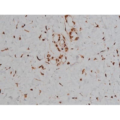MAPT / Tau Antibody (phospho-Thr231)
