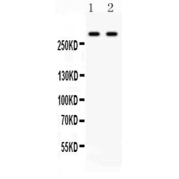 Polyclonal Rabbit anti-Human ITPR3 Antibody (aa70-95, IHC, WB)
