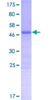 Human CT45A1 Protein (Recombinant GST)