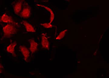 IKBKG / NEMO / IKK Gamma Antibody (phospho-Ser31)