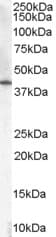 IHC-plus™ Polyclonal Goat anti-Human HSD3B1 Antibody (aa362-373, IHC, WB)