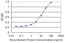 RIOK2 Antibody (clone 1B10)
