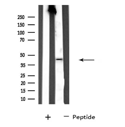 Polyclonal Rabbit anti-Human SERPINA11 Antibody (IF, WB)