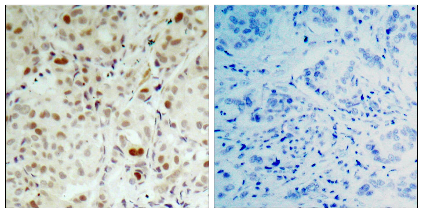 RB1 / Retinoblastoma / RB Antibody (phospho-Ser807)