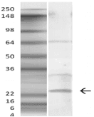 SOD1 / Cu-Zn SOD Antibody