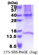 Human GNB3 Protein (Recombinant His)
