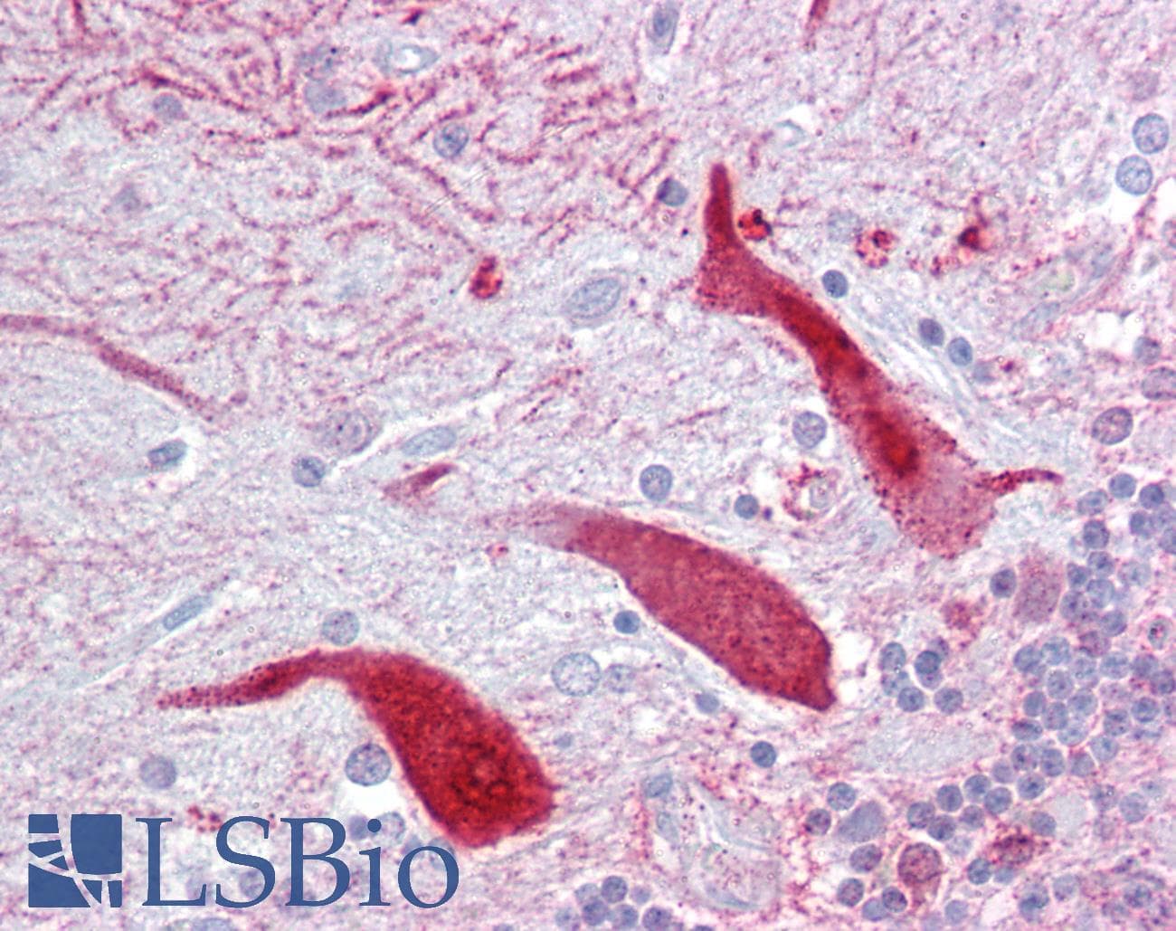 Polyclonal Rabbit anti-Human KCNQ2 Antibody (aa179-228, IHC, WB)