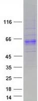 Human PXYLP1 / ACPL2 Protein (Recombinant Myc-DDK (Flag))