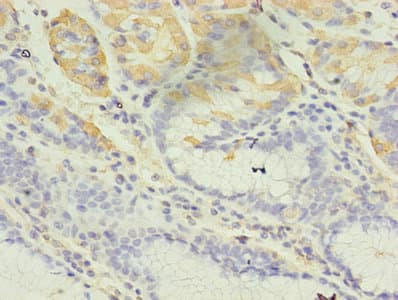 GIF / Intrinsic Factor Antibody (aa19-417)