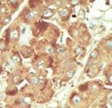 NLK Antibody (aa406-436)