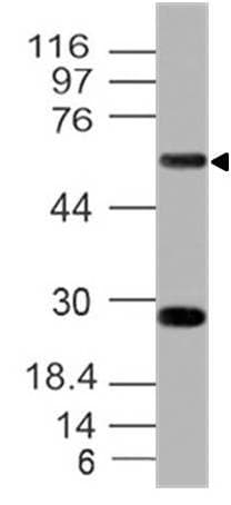 CD39 Antibody