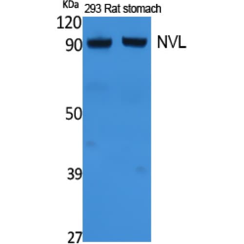 NVL Antibody (320-400 aa, Internal)