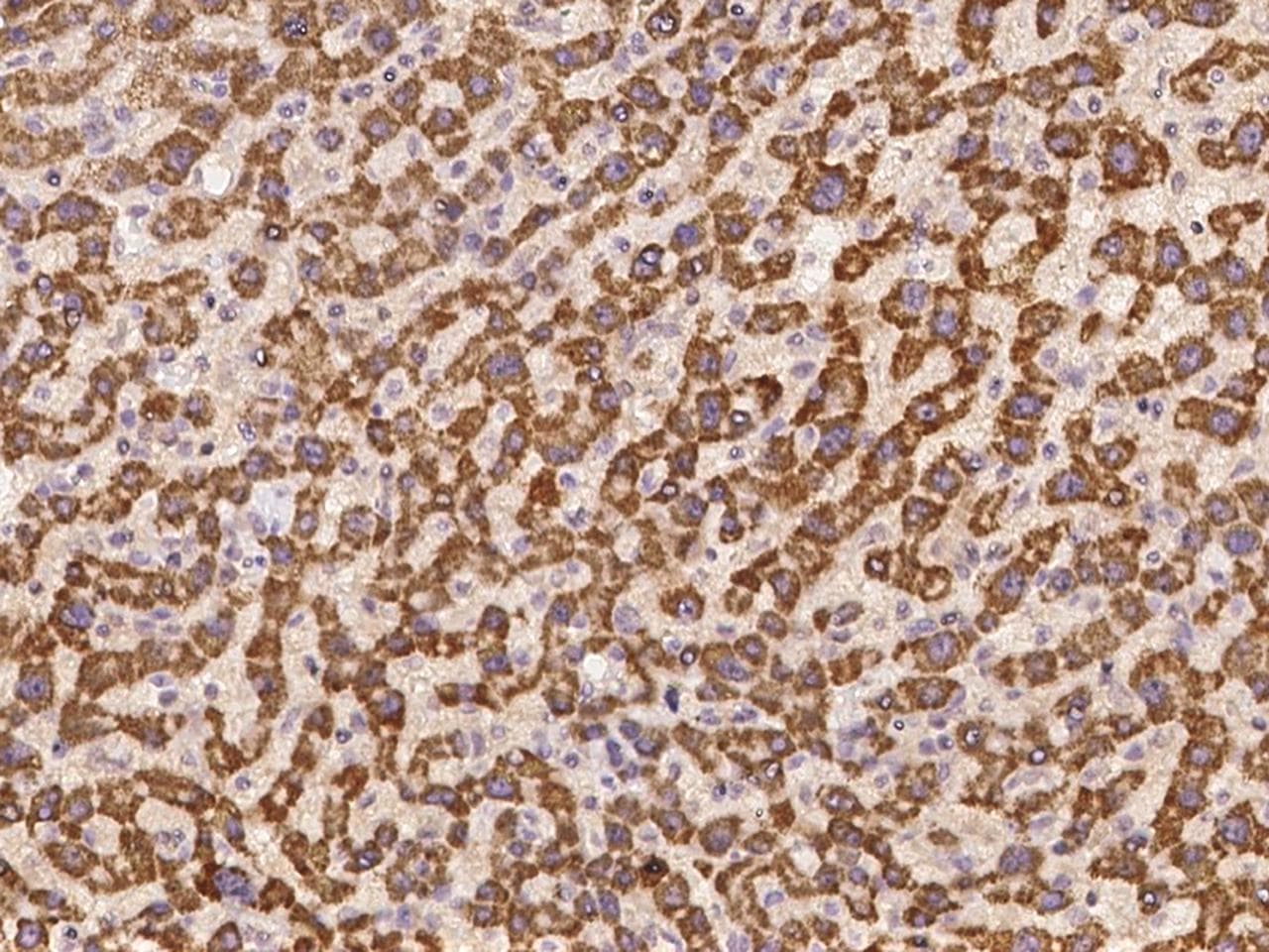 Polyclonal Rabbit anti-Human SLC35F4 Antibody (IHC)