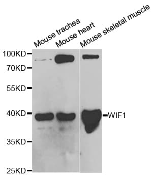 Polyclonal Rabbit anti-Human WIF1 Antibody (IHC, IF, WB)