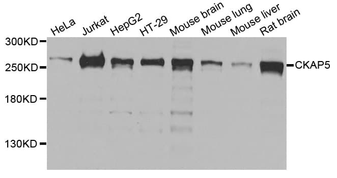 Polyclonal Rabbit anti-Human CKAP5 / ch-TOG Antibody (AP, WB)