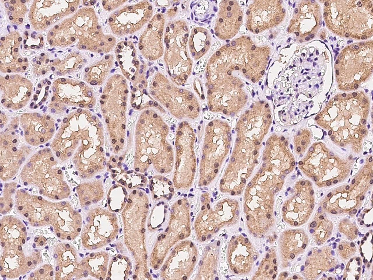 Polyclonal Rabbit anti-Human IFT122 / WDR10 Antibody (IHC, IF)