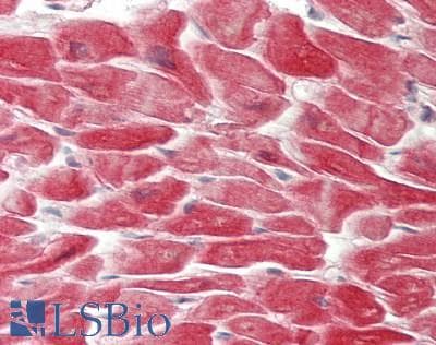 IHC-plus™ GYS1 / Glycogen Synthase Antibody