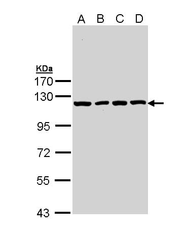 PathPlus™ Polyclonal Rabbit anti-Human IDE Antibody (IHC, WB)
