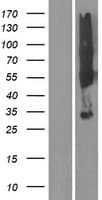 SYPL2 Protein (Over-Expression Lysate Myc-DDK (Flag))
