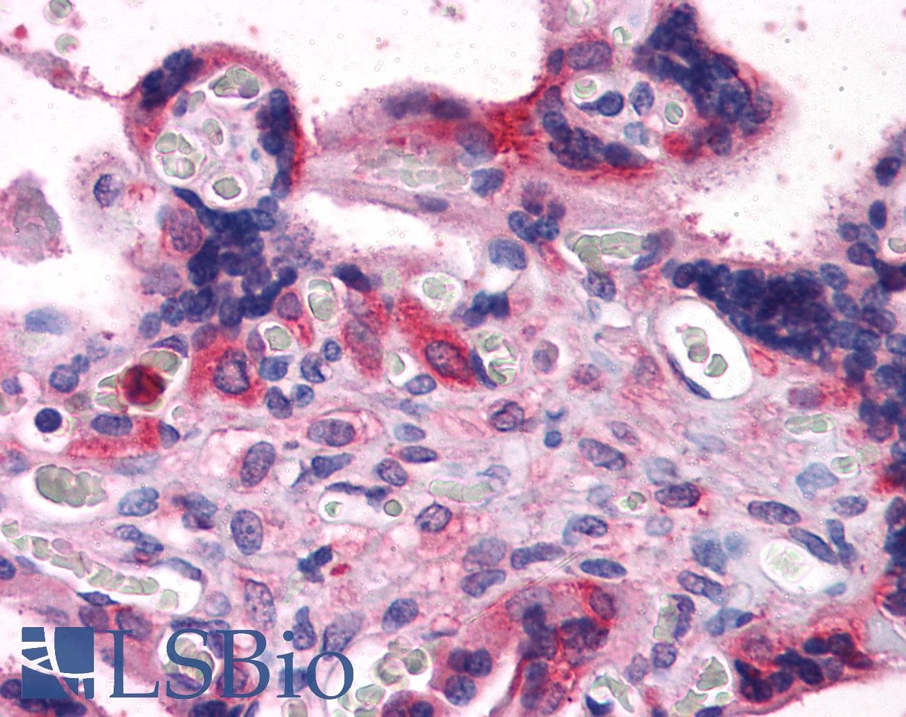 IHC-plus™ Polyclonal Goat anti-Human BAG3 / BAG-3 Antibody (aa563-575, IHC, WB)