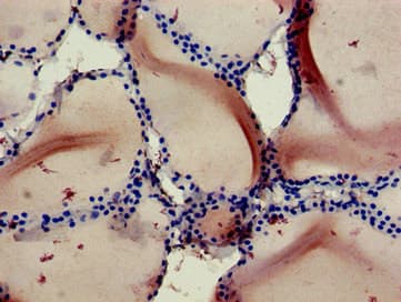 Polyclonal Rabbit anti-Human RBCK1 Antibody (IHC)