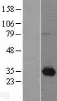 NMNAT1 / NMNAT Protein (Over-Expression Lysate Myc-DDK (Flag))