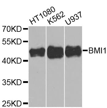 Polyclonal Rabbit anti-Human BMI1 / PCGF4 Antibody (IHC, IF, WB)