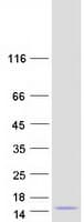 Human CCL4L1 Protein (Recombinant Myc-DDK (Flag))