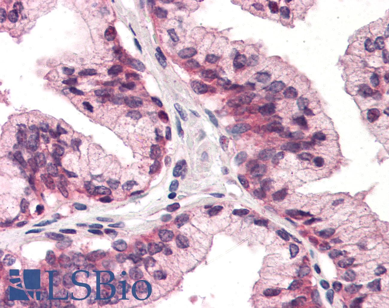 IHC-plus™ ATP1B3 Antibody (Internal)